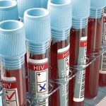 Hiv
