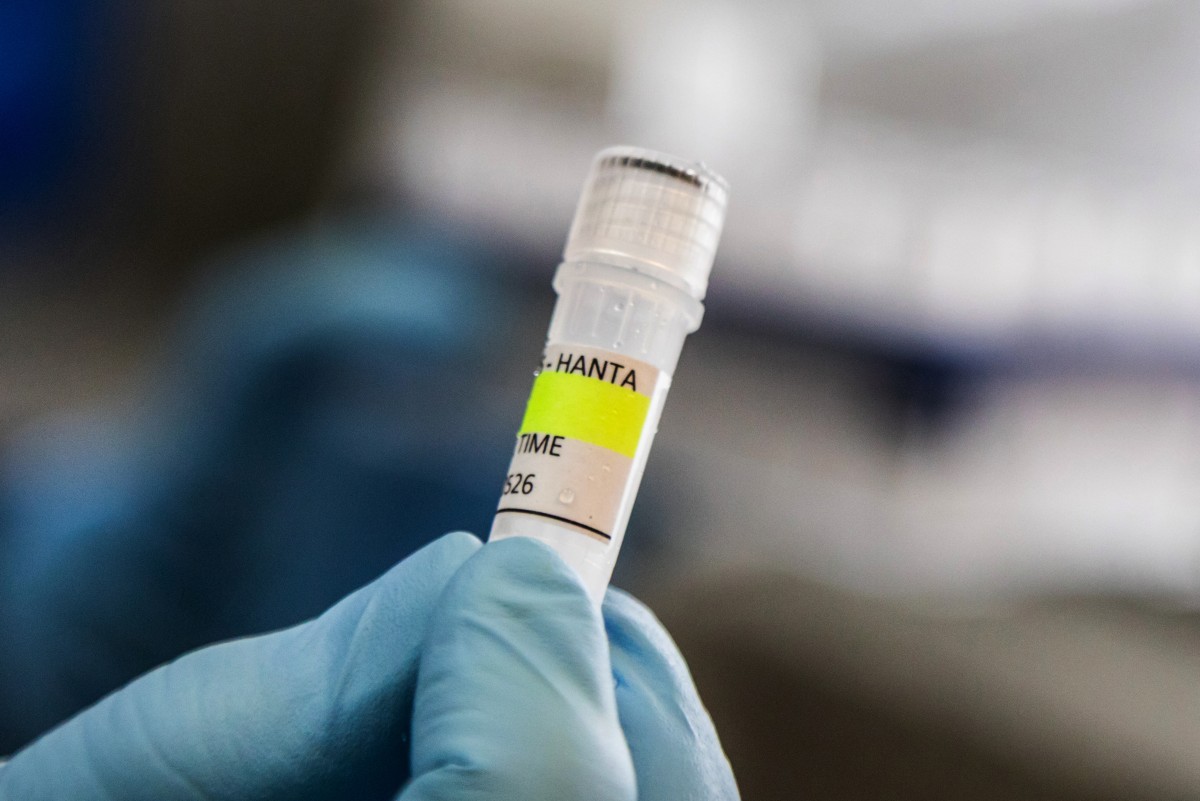 Dutch Doctor Says Hantavirus Outbreak on Cruise Ship Is Not ‘Another Covid’